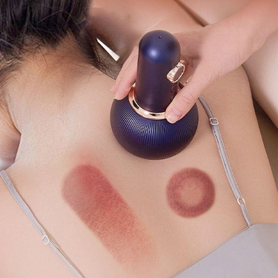 Συσκευή μασάζ με βεντούζα - S-98 - 813621