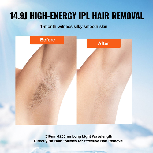 VEVOR IPL Αποτρίχωση Laser Αποτρίχωση με λέιζερ Αυτόματη/Μη αυτόματη λειτουργία 5 ρυθμιζόμενων επιπέδων